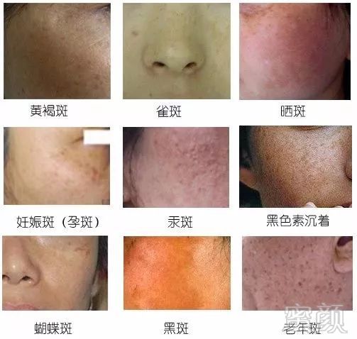 https://img.miyanlife.com/mnt/timg/190212/1245594D0-1.jpg