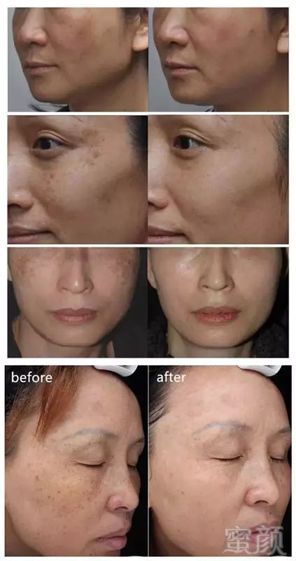 https://img.miyanlife.com/mnt/timg/190212/1246005293-6.jpg