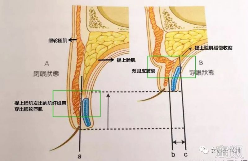 案例图片