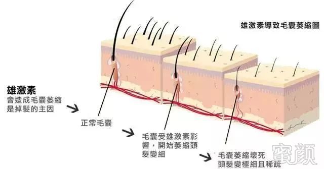 案例图片