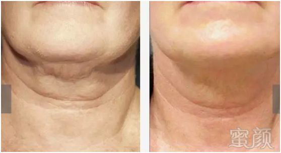 https://img.miyanlife.com/mnt/timg/190213/110I21530-6.jpg