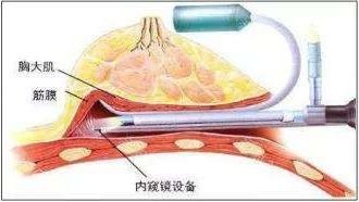 案例图片