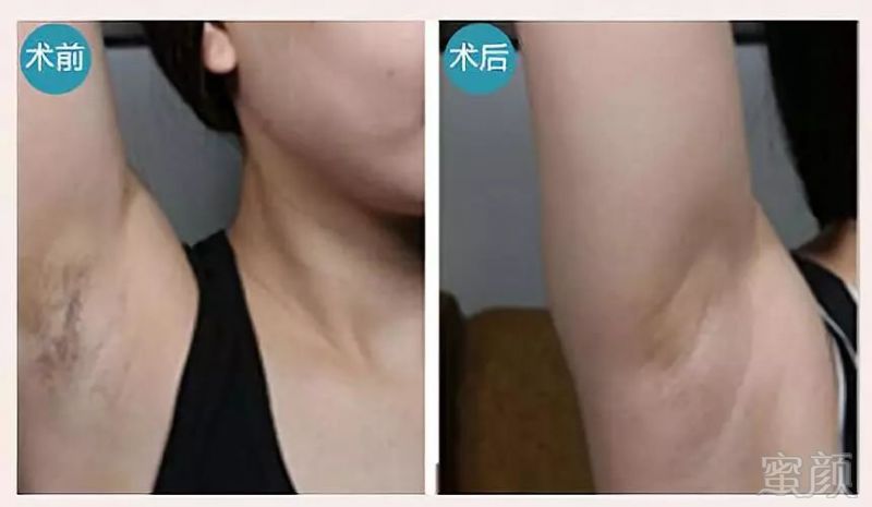https://img.miyanlife.com/mnt/timg/190213/113U04105-5.jpg