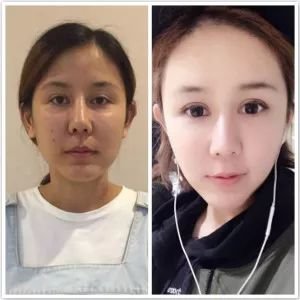 https://img.miyanlife.com/mnt/timg/190213/1141554560-9.jpg