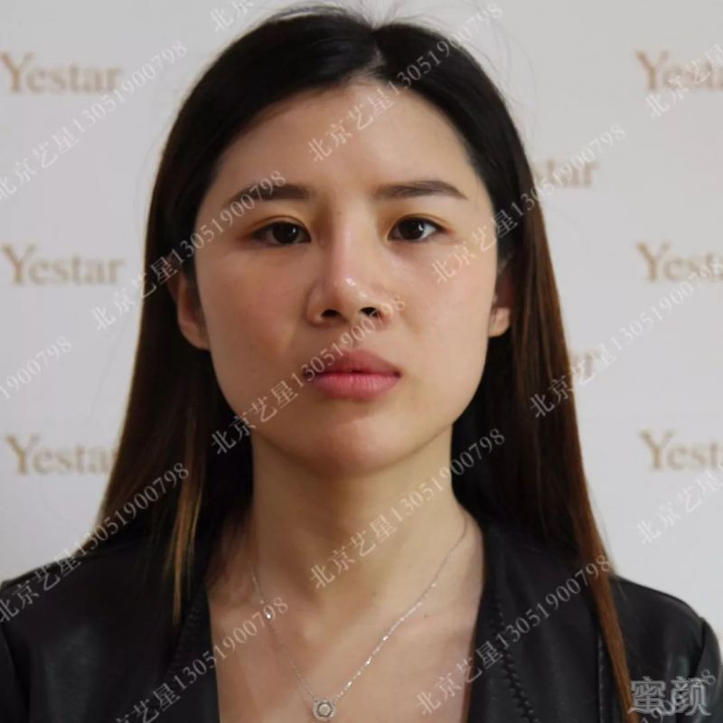 https://img.miyanlife.com/mnt/timg/190213/1150554333-0.jpg