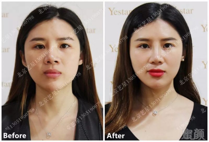 https://img.miyanlife.com/mnt/timg/190213/11505Ia6-2.jpg
