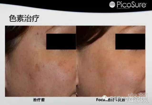 https://img.miyanlife.com/mnt/timg/190213/120U135H-2.jpg