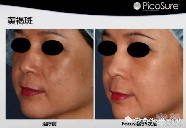 https://img.miyanlife.com/mnt/timg/190213/120U16206-1.jpg