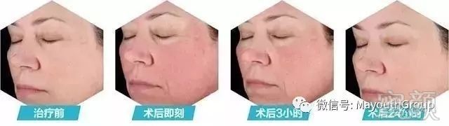 https://img.miyanlife.com/mnt/timg/190213/120U1K23-7.jpg