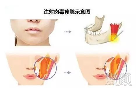 https://img.miyanlife.com/mnt/timg/190214/1135295G5-2.jpg