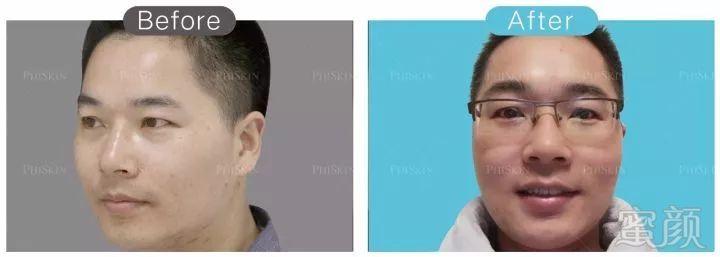 https://img.miyanlife.com/mnt/timg/190214/1200343D2-10.jpg