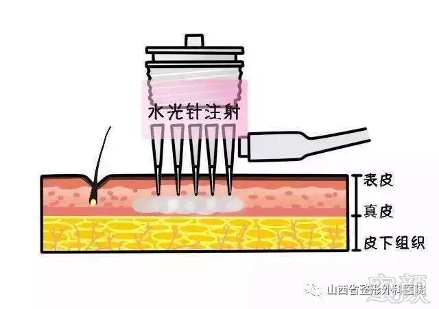 案例图片