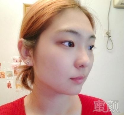 https://img.miyanlife.com/mnt/timg/190215/11510435c-2.jpg
