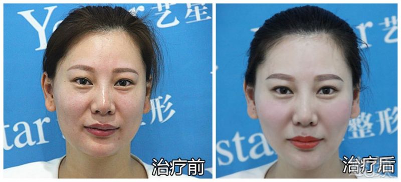 https://img.miyanlife.com/mnt/timg/190215/1210116321-7.jpg