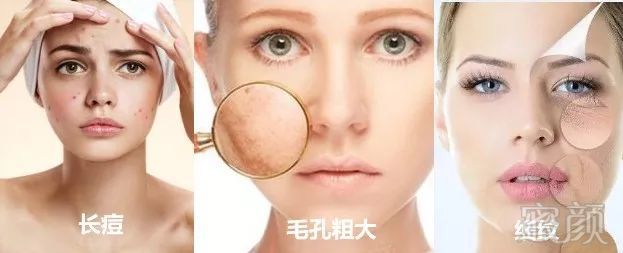 https://img.miyanlife.com/mnt/timg/190216/134450B51-1.jpg