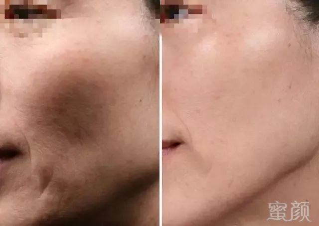 https://img.miyanlife.com/mnt/timg/190216/1344514Y7-5.jpg