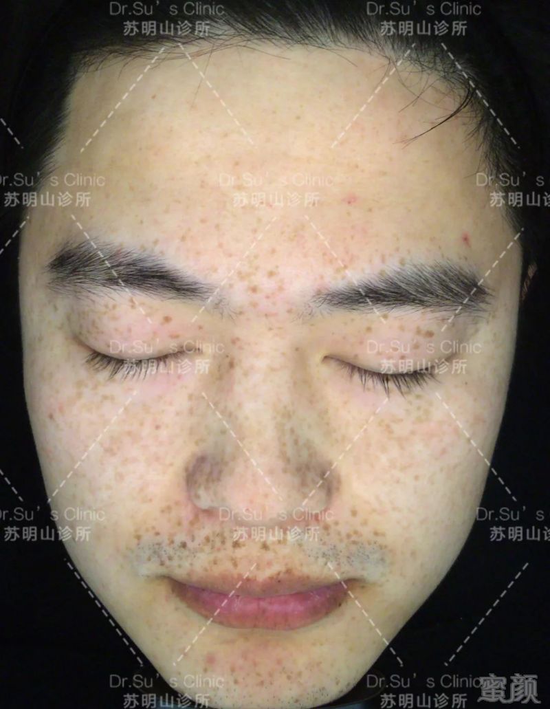 https://img.miyanlife.com/mnt/timg/190217/1241464Y1-0.jpg