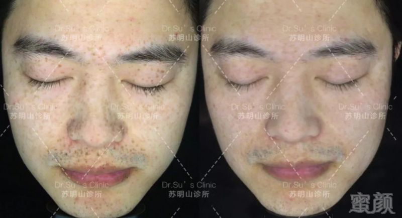 https://img.miyanlife.com/mnt/timg/190217/1241505643-6.jpg