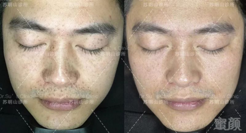 https://img.miyanlife.com/mnt/timg/190217/1241513W2-7.jpg
