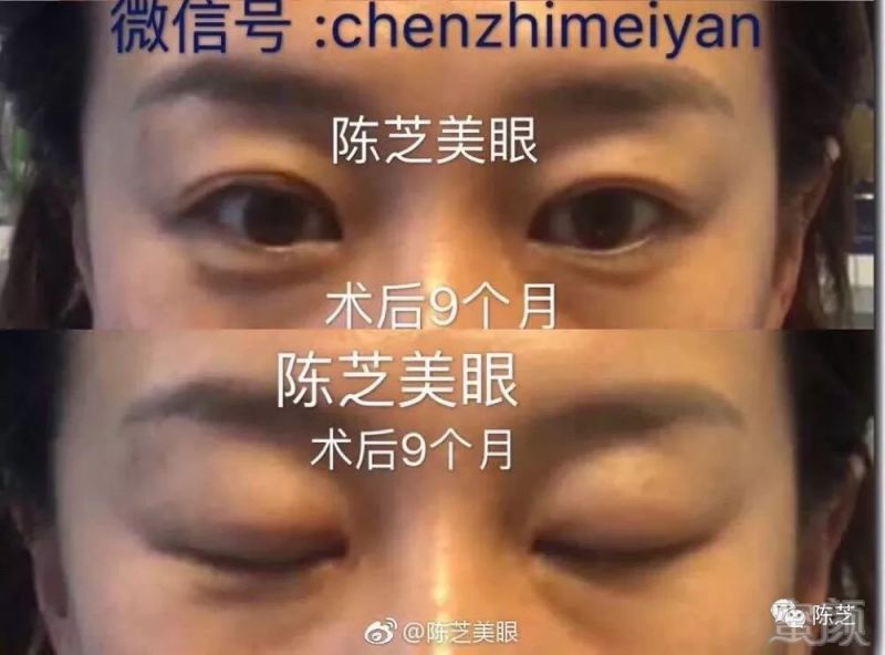 https://img.miyanlife.com/mnt/timg/190217/1303231M7-2.jpg