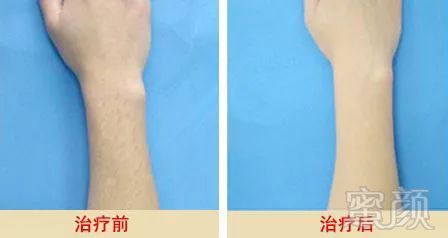 https://img.miyanlife.com/mnt/timg/190220/12211Q4E-8.jpg