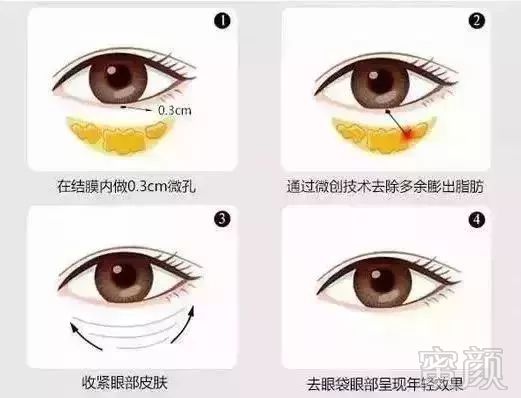 https://img.miyanlife.com/mnt/timg/190220/12353KS7-3.jpg