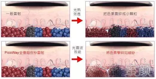 https://img.miyanlife.com/mnt/timg/190220/1256133105-4.jpg