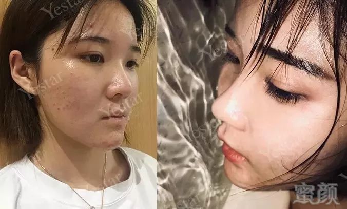 https://img.miyanlife.com/mnt/timg/190220/130UU453-6.jpg