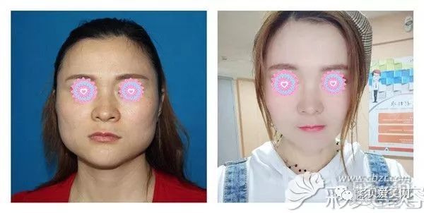 案例图片