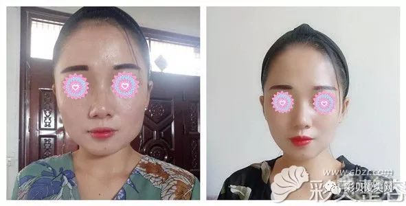 案例图片