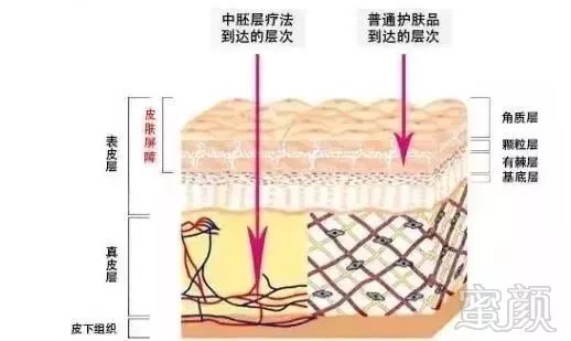 https://img.miyanlife.com/mnt/timg/190220/133R132M-5.jpg