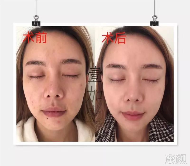https://img.miyanlife.com/mnt/timg/190221/1259254513-1.jpg