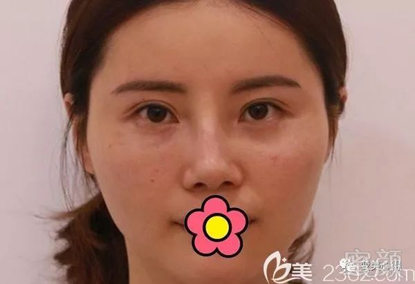 案例图片