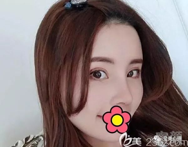 案例图片