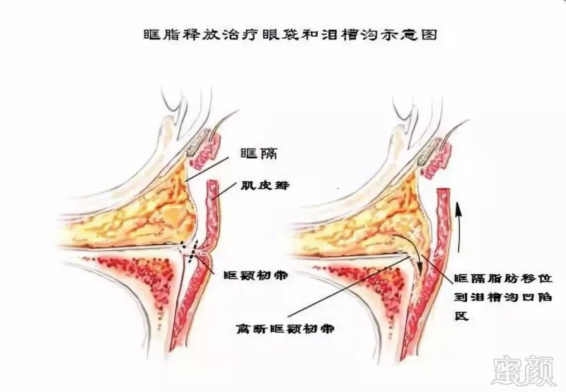 案例图片