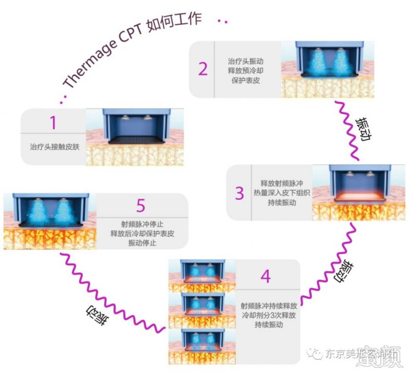 https://img.miyanlife.com/mnt/timg/190221/1330111457-1.jpg