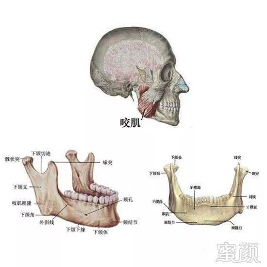 案例图片