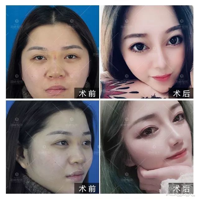 https://img.miyanlife.com/mnt/timg/190221/13521CI5-4.jpg