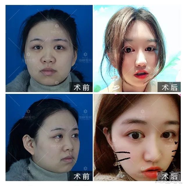 https://img.miyanlife.com/mnt/timg/190221/13521L028-8.jpg