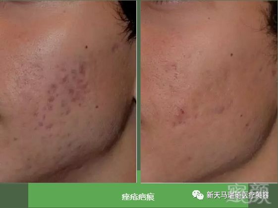 https://img.miyanlife.com/mnt/timg/190221/1409252954-10.jpg