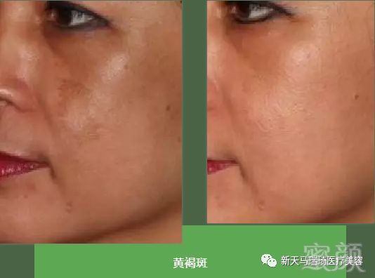 https://img.miyanlife.com/mnt/timg/190221/140925Dc-8.jpg