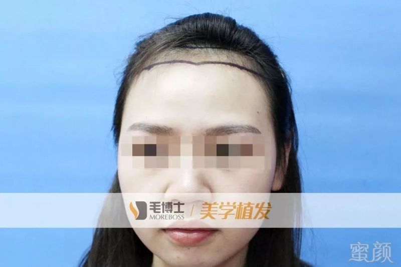 https://img.miyanlife.com/mnt/timg/190221/14164S2F-1.jpg