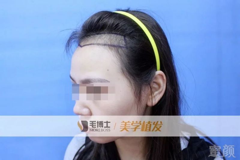 https://img.miyanlife.com/mnt/timg/190221/14164UV3-3.jpg