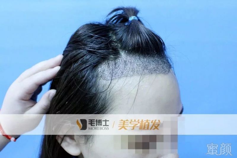 https://img.miyanlife.com/mnt/timg/190221/141A04156-8.jpg