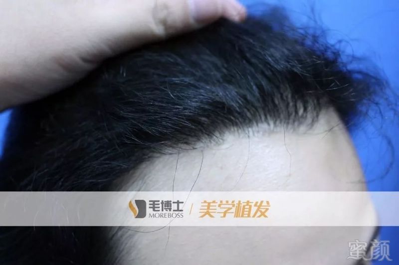 https://img.miyanlife.com/mnt/timg/190221/141A1AM-13.jpg