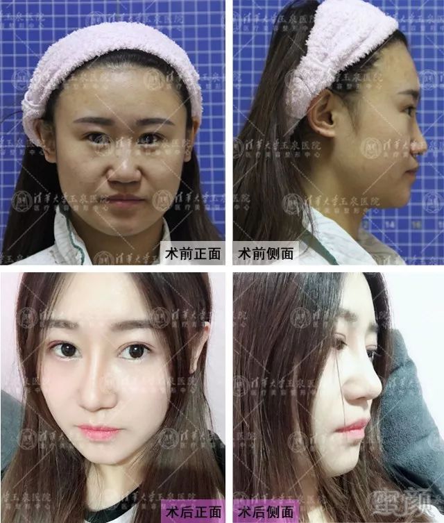 https://img.miyanlife.com/mnt/timg/190222/11505G434-0.jpg