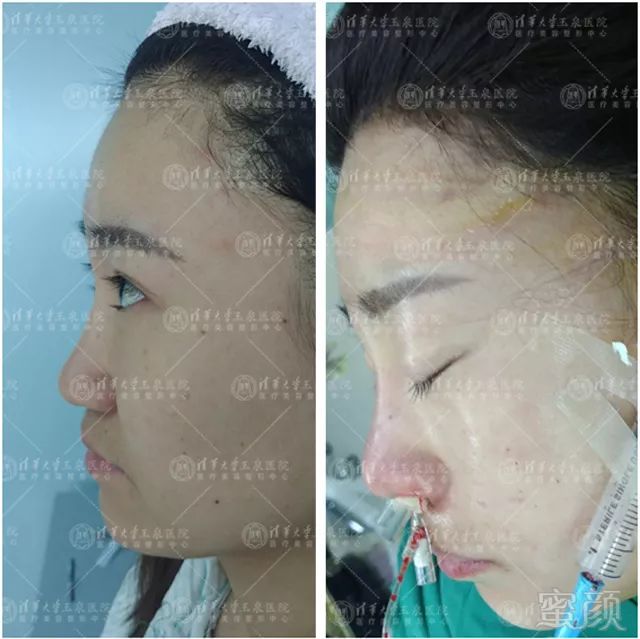 https://img.miyanlife.com/mnt/timg/190222/11505Q630-2.jpg