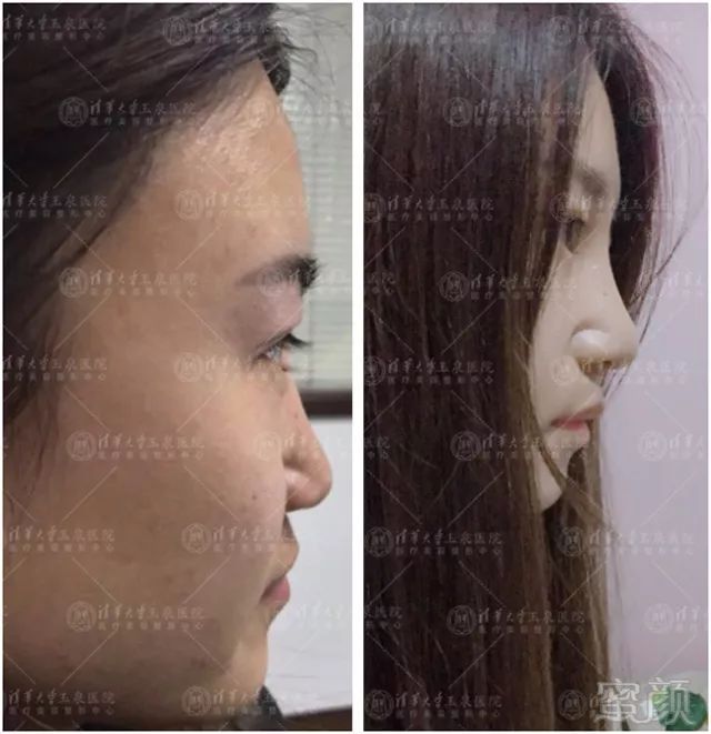 https://img.miyanlife.com/mnt/timg/190222/11505RX3-5.jpg