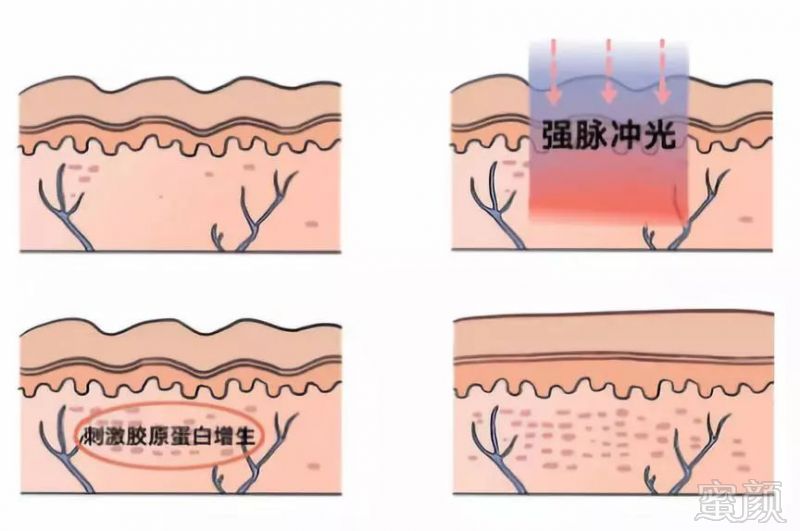 案例图片