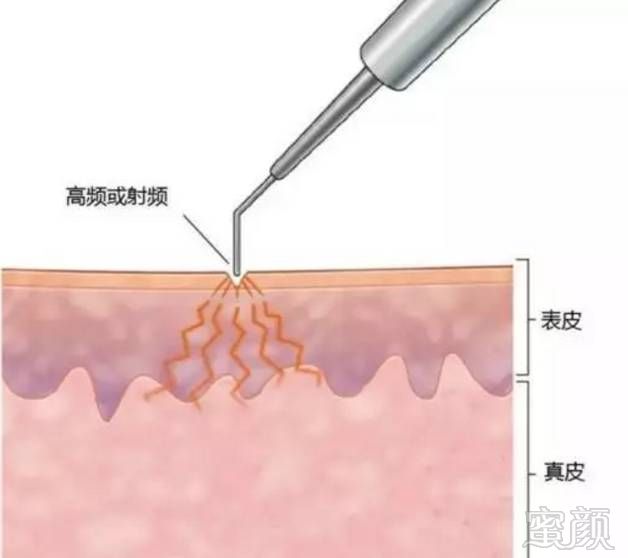 案例图片